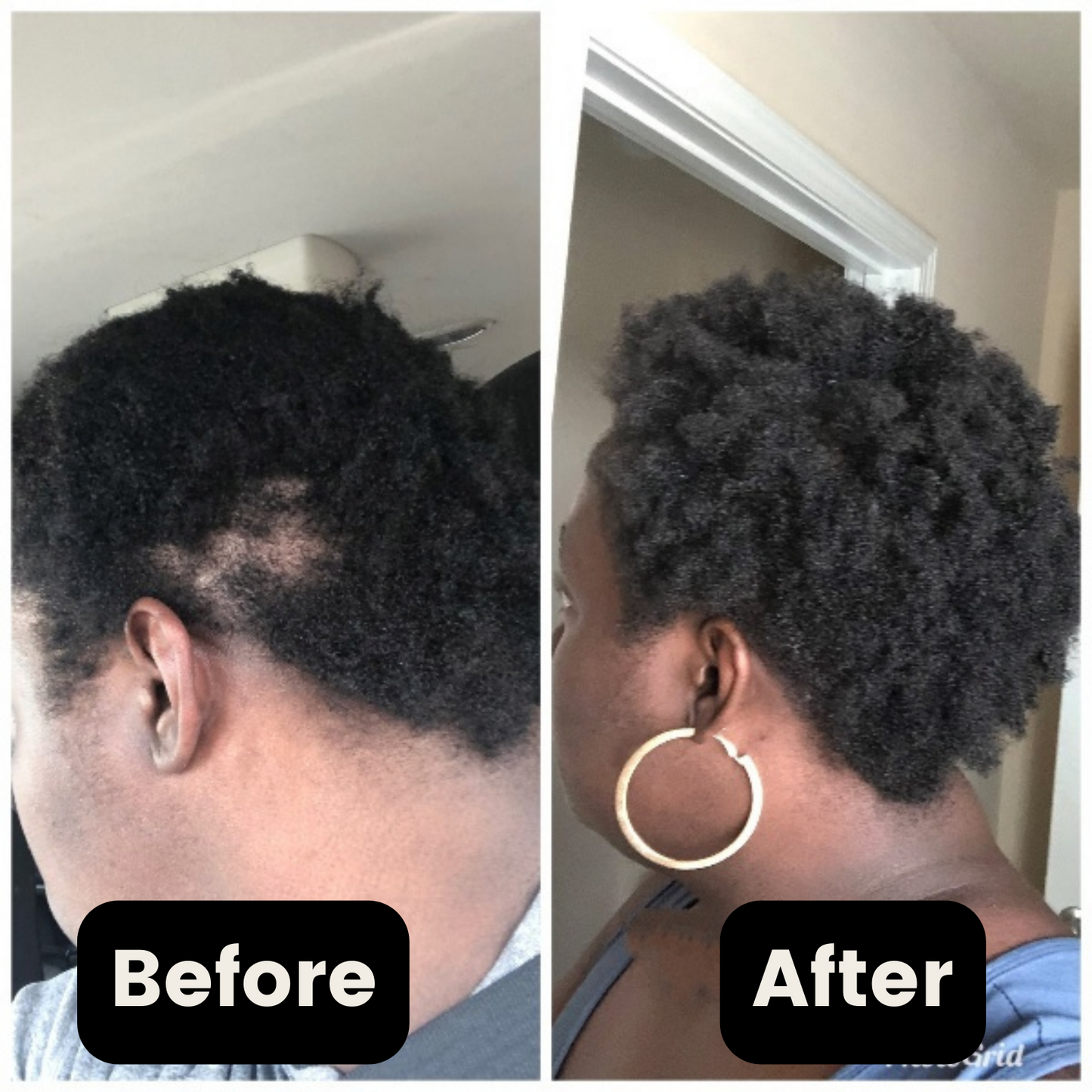 2 x Yes Melanin - Hair Growth Serum [60 Day Supply]