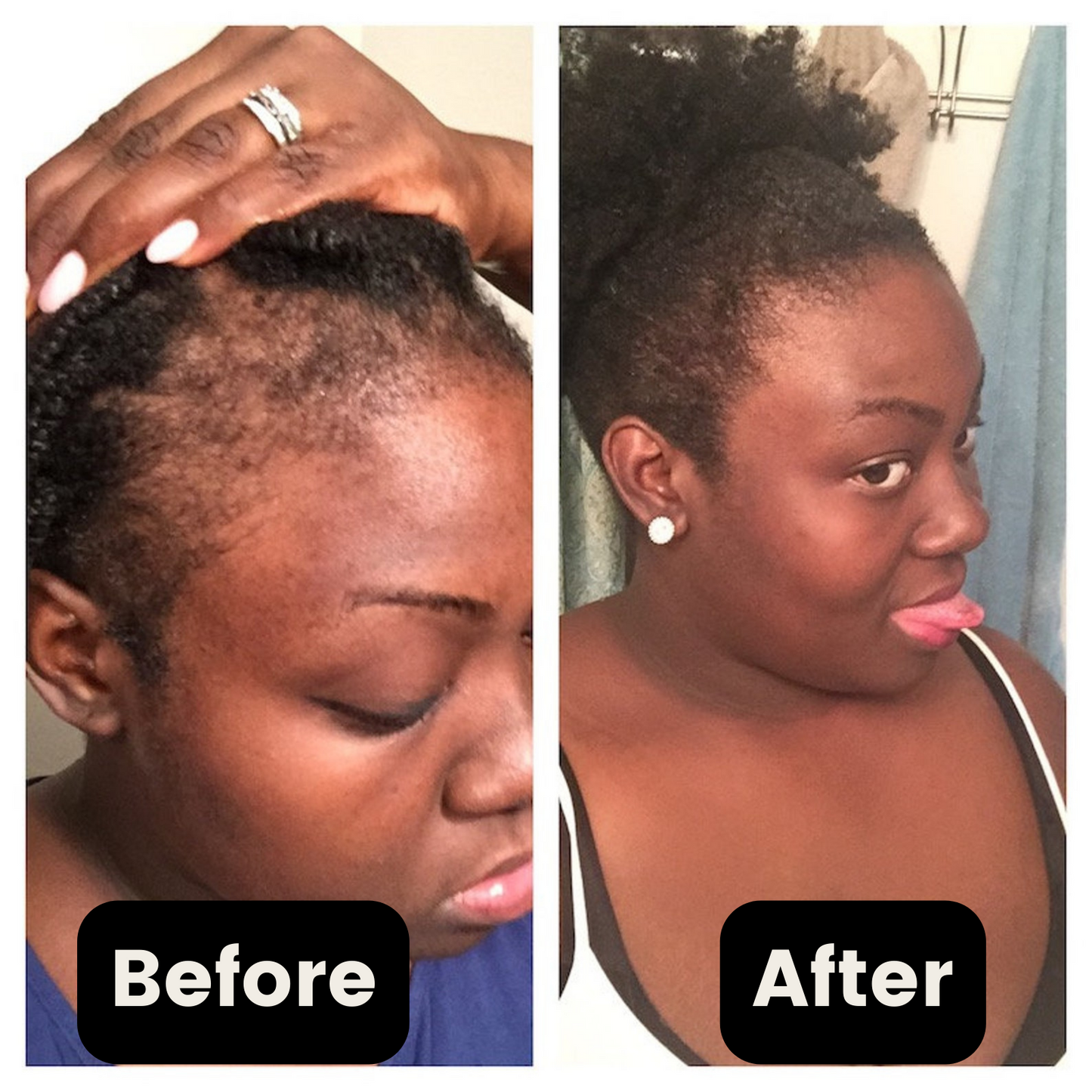 4 x Yes Melanin - Hair Growth Serum [120 Day Supply]